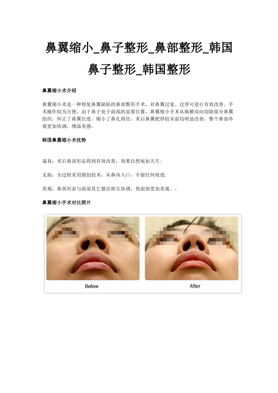 鼻翼缩小_鼻子整形_鼻部整形_韩国鼻子整形_第1页