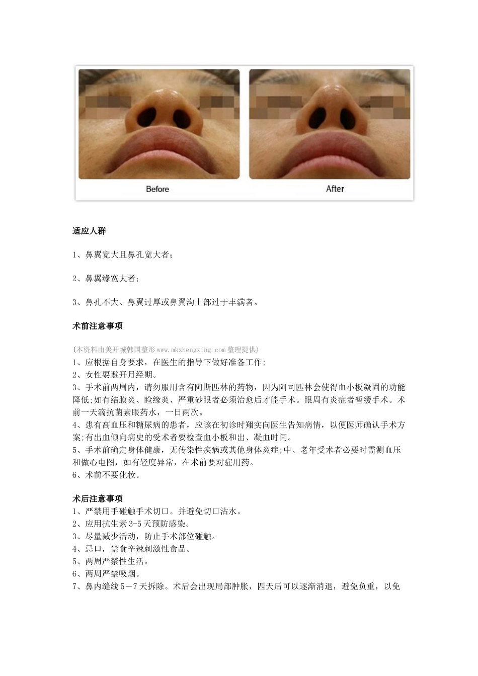 鼻翼缩小_鼻子整形_鼻部整形_韩国鼻子整形_第2页