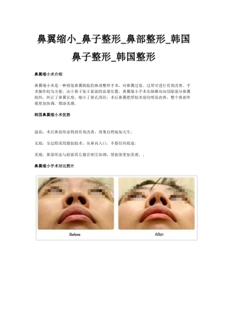 鼻翼缩小_鼻子整形_鼻部整形_韩国鼻子整形