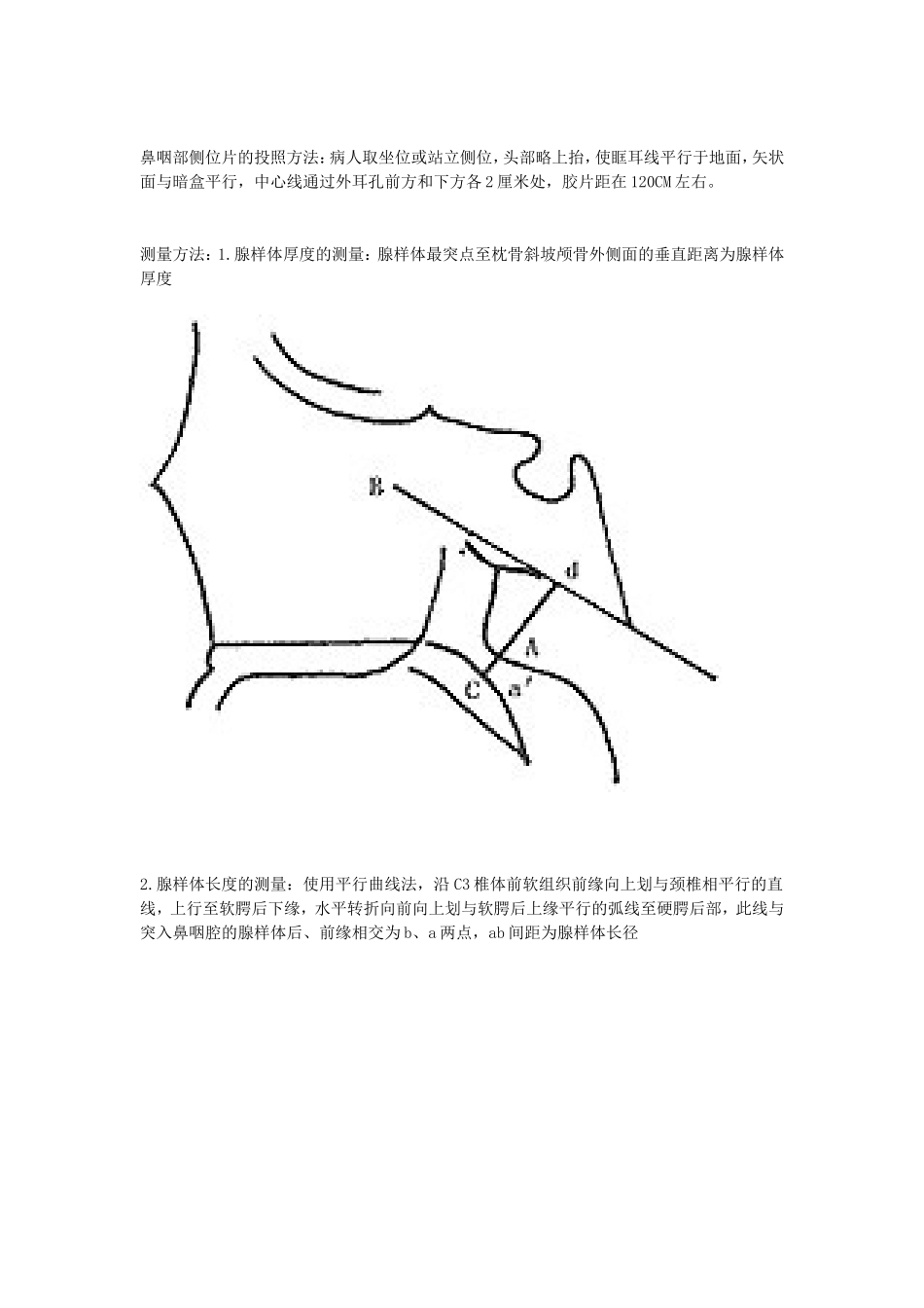 鼻咽增殖体肥大_第2页