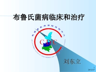 布鲁氏菌病临床和治疗