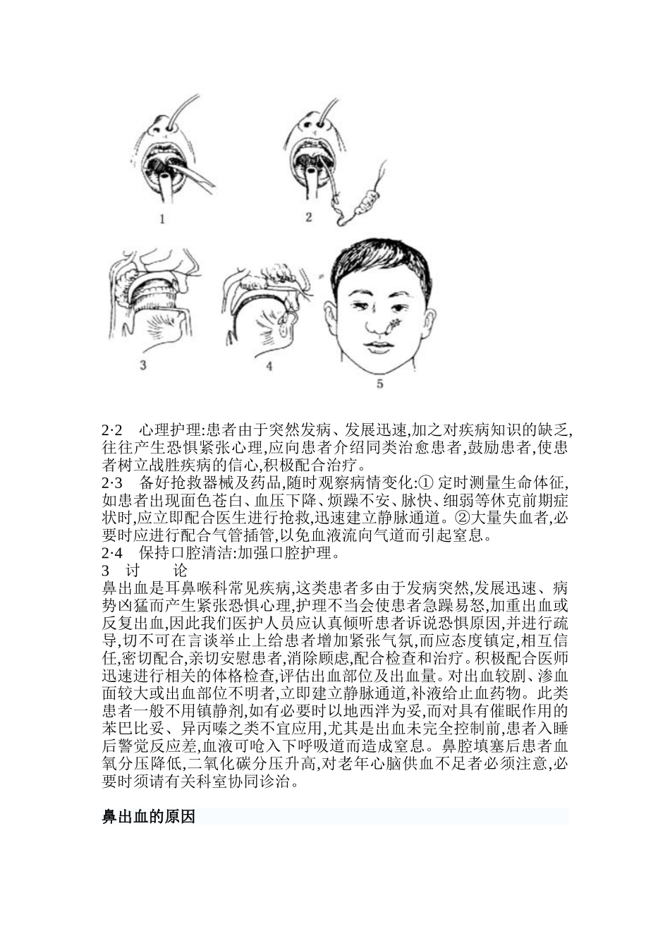鼻出血急救护理_第2页