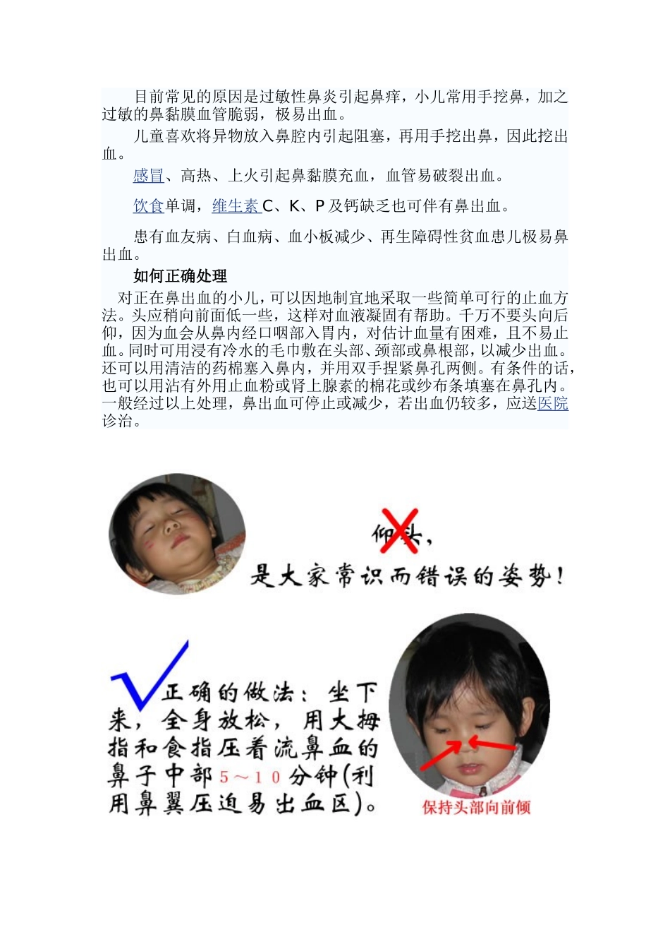 鼻出血急救护理_第3页