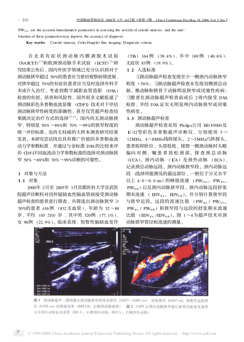 超声检查对颈动脉狭窄50_69_和70_99_诊断准确性的评估_第2页