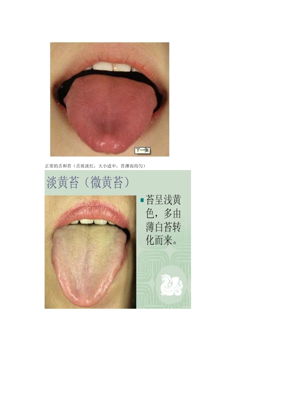 带状疱疹的诊治(个人经历)_第3页