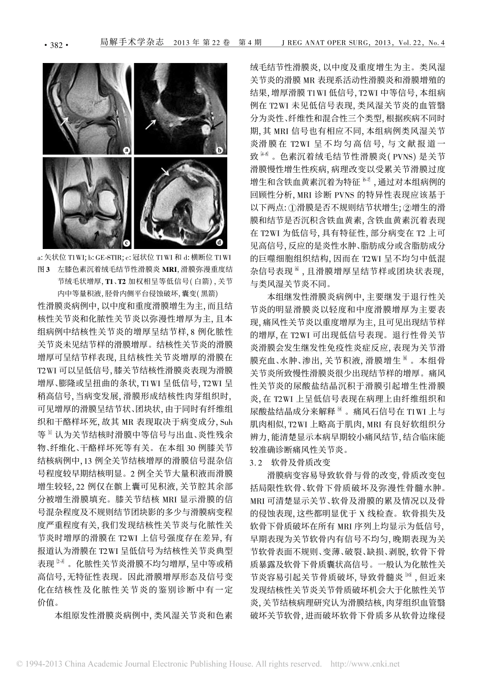 低场强四肢关节MRI对膝关节滑膜病变的诊断_第3页