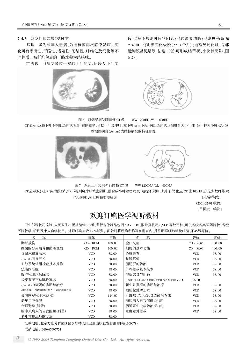 第10讲 胸部疾病的CT诊断1(一)_第3页