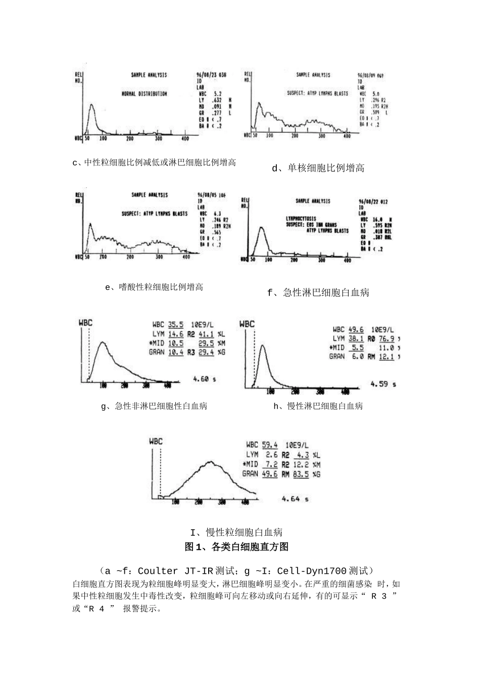 白细胞直方图的特点与临床意义2_第3页