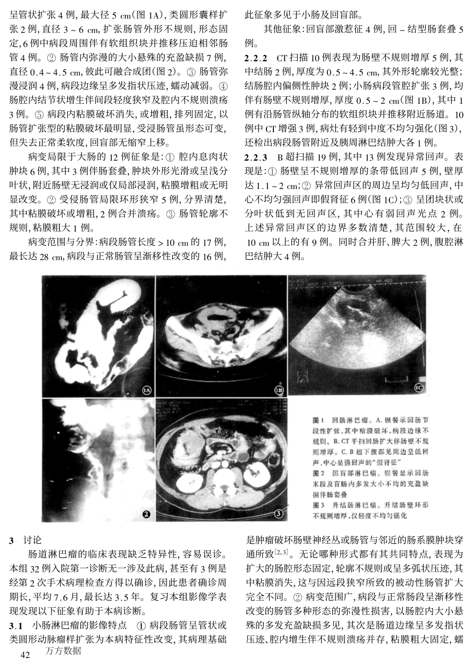肠道恶性淋巴瘤的影像诊断_第2页
