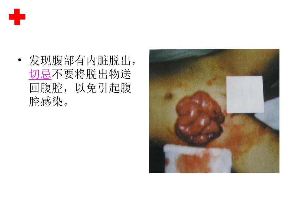 2015.11.18  肠外溢_第3页