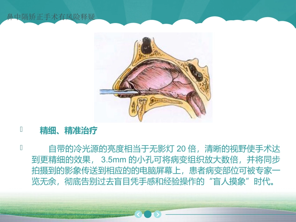 鼻中隔矫正手术有风险释疑_第3页