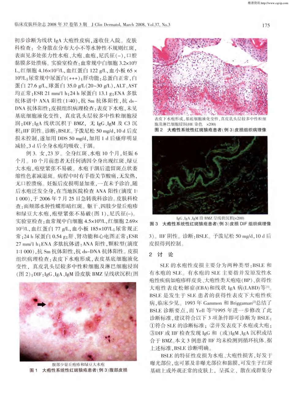 大疱性系统性红斑狼疮3例及文献复习_第2页