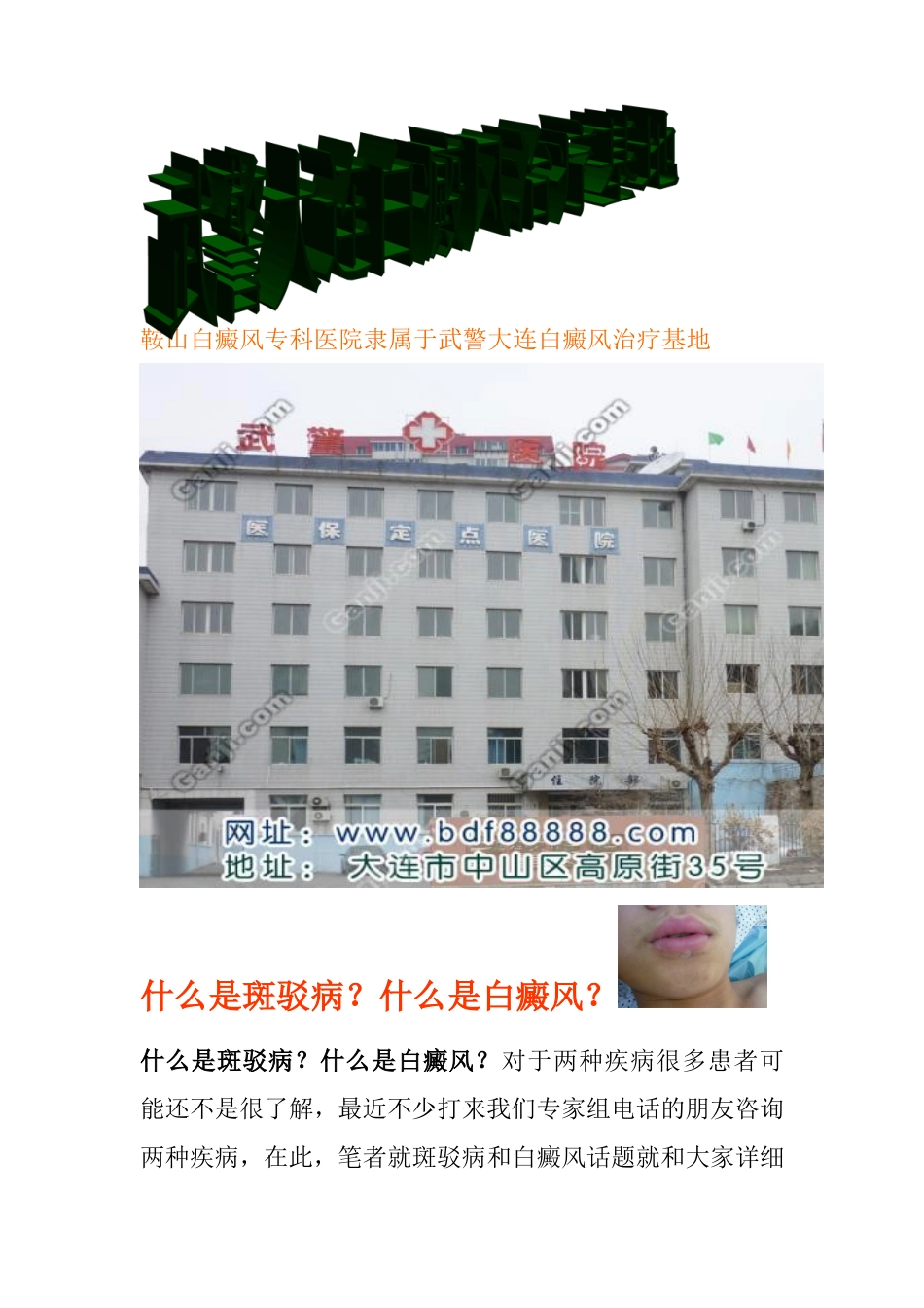 鞍山白癜风专科医院_第1页