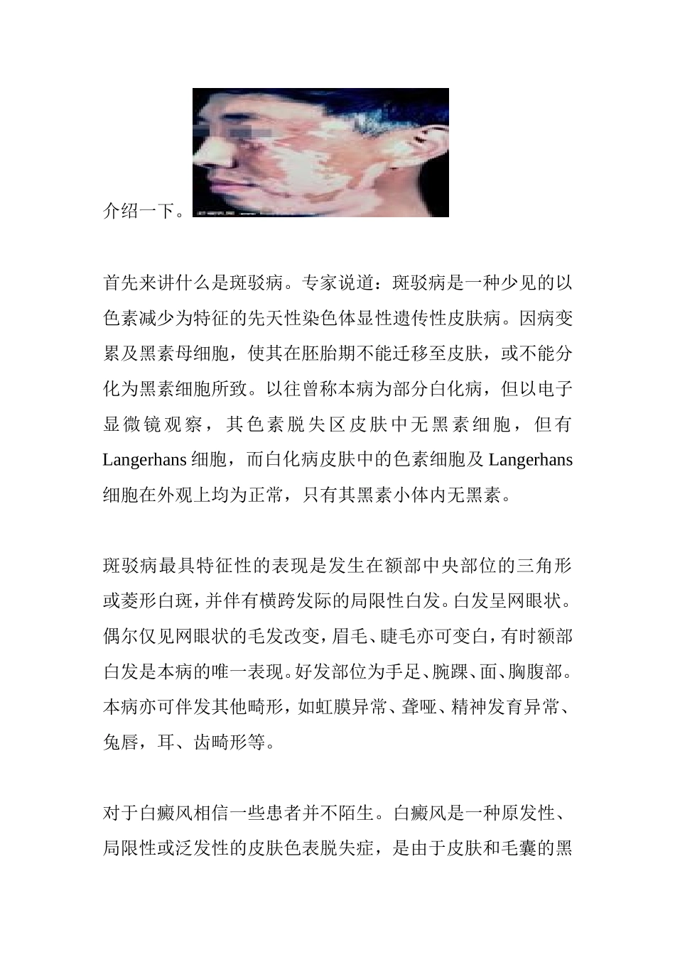 鞍山白癜风专科医院_第2页
