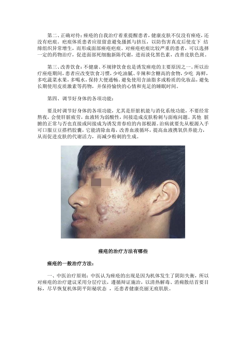 痤疮的治疗方法有哪些_第2页