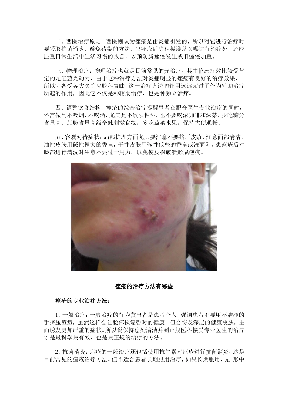 痤疮的治疗方法有哪些_第3页