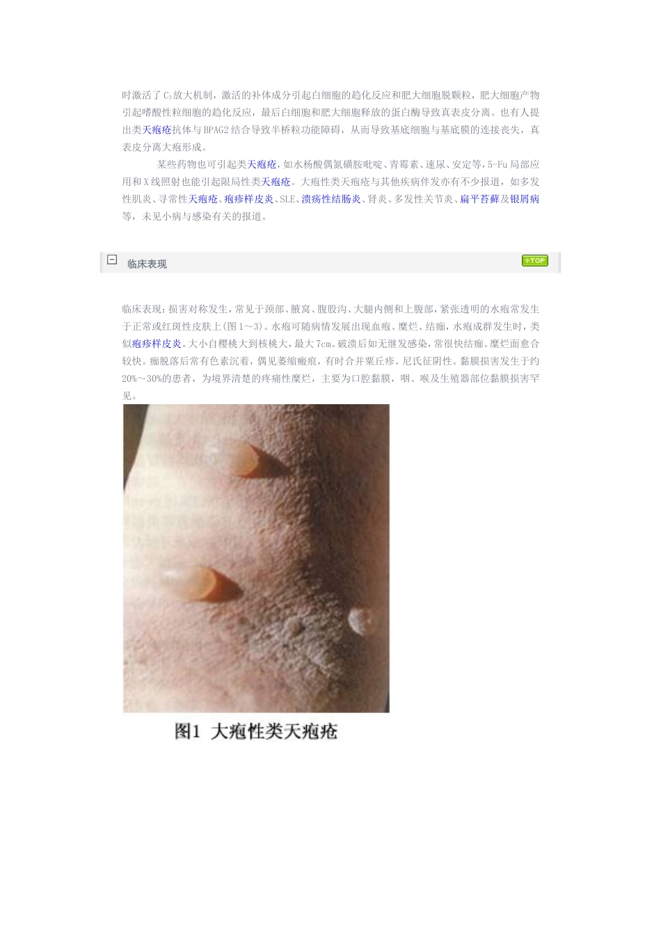 大疱类性天疱疮_第2页