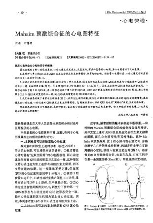 Mahim预激综合征的心电图特征
