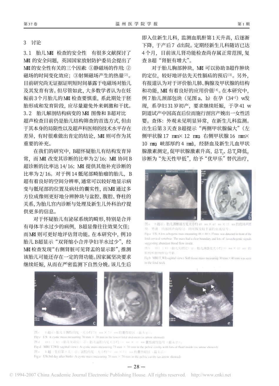 磁共振成像在诊断胎儿先天性发育异常中的应用_第3页