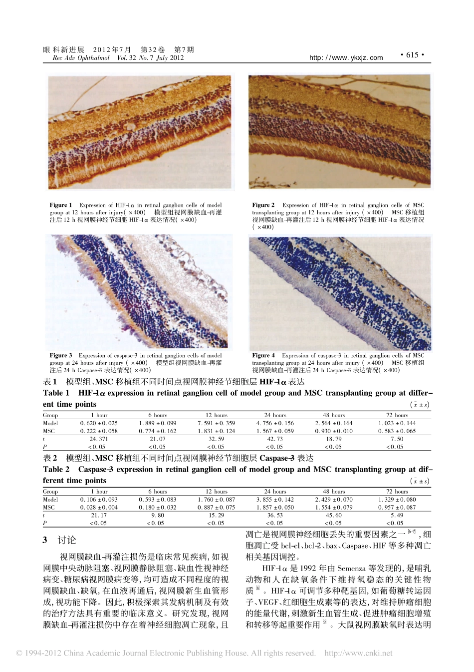 MSC移植对视网膜缺血_再灌注损伤后神经节_省略_HIF_1_及Caspase__第3页