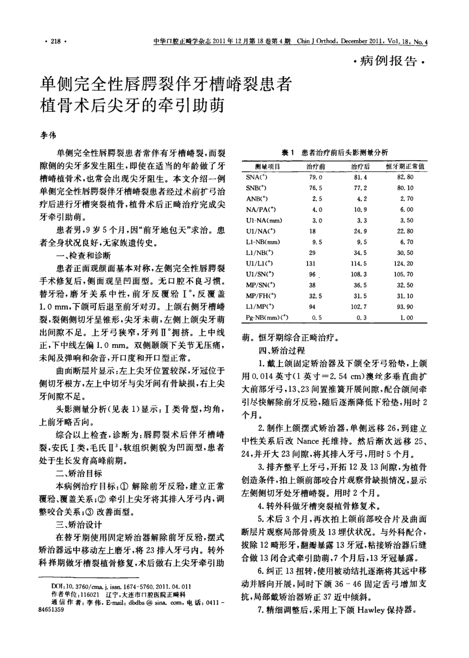 单侧完全性唇腭裂伴牙槽嵴裂患者植骨术后尖牙的牵引助萌_第1页