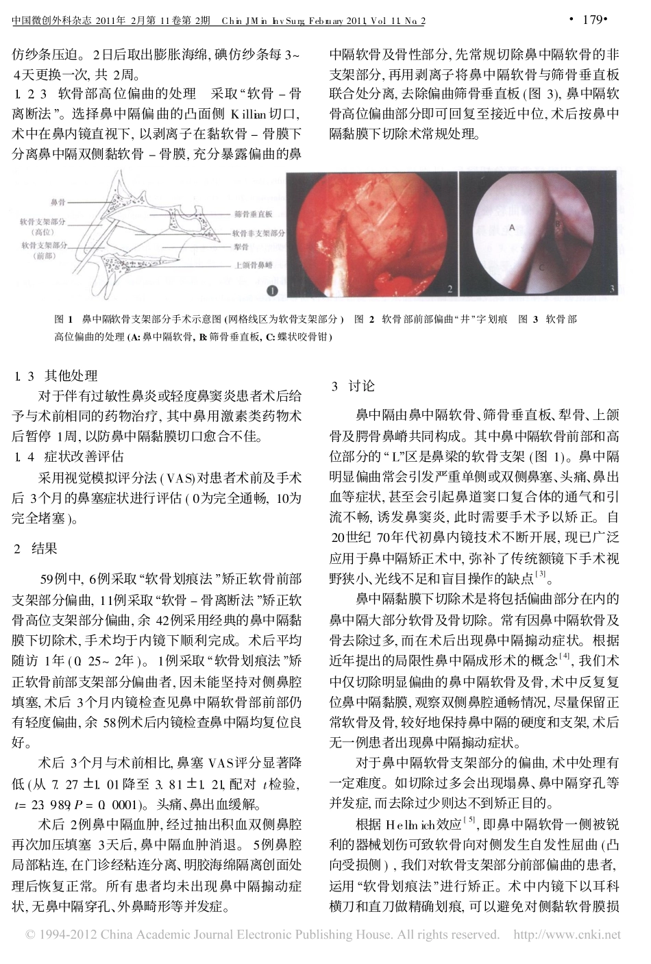鼻内镜下鼻中隔偏曲矫正的手术技巧_第2页