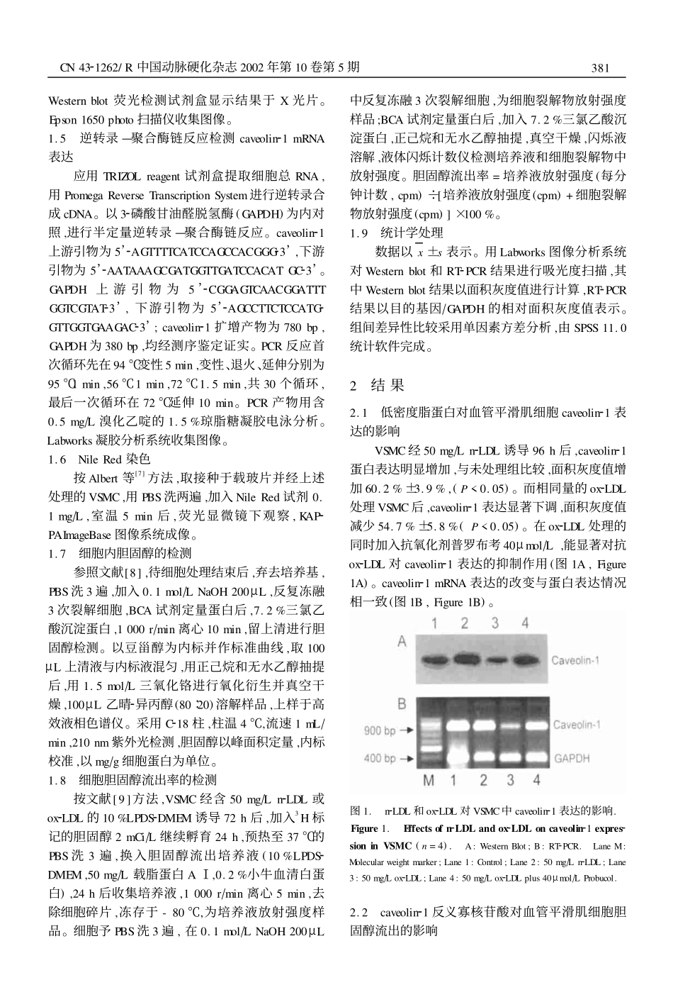 Caveolin21表达对血管平滑肌细胞胆固醇逆转运的调节作用_第3页