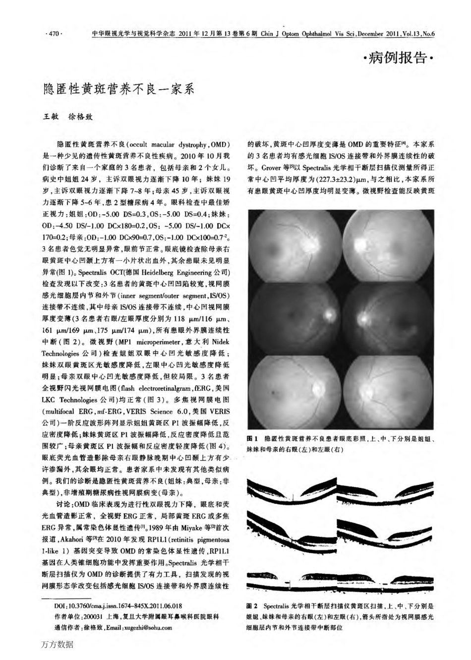 Case Report 隐匿性黄斑营养不良一家系_第1页