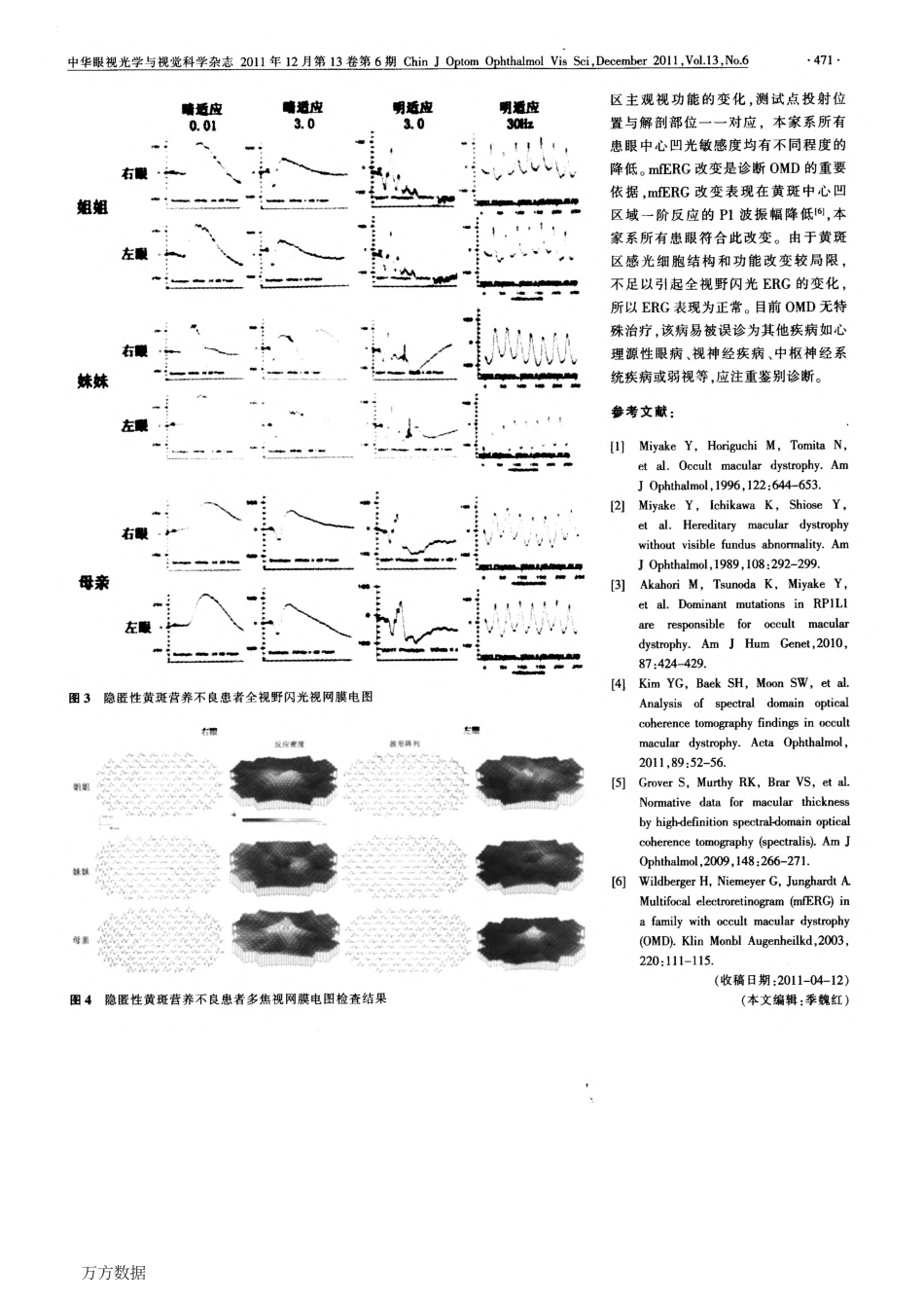 Case Report 隐匿性黄斑营养不良一家系_第2页
