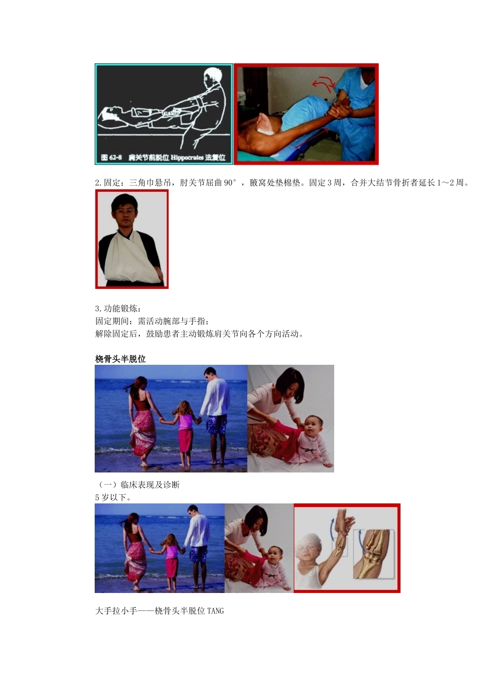 常见关节脱位Microsoft Word 文档_第3页