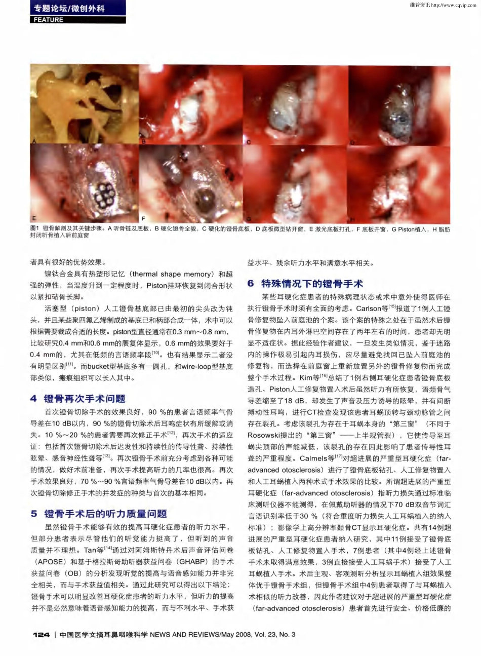 镫骨手术几个值得关注的问题_第2页