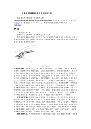 玻璃体及视网膜脱离手术所致青光眼