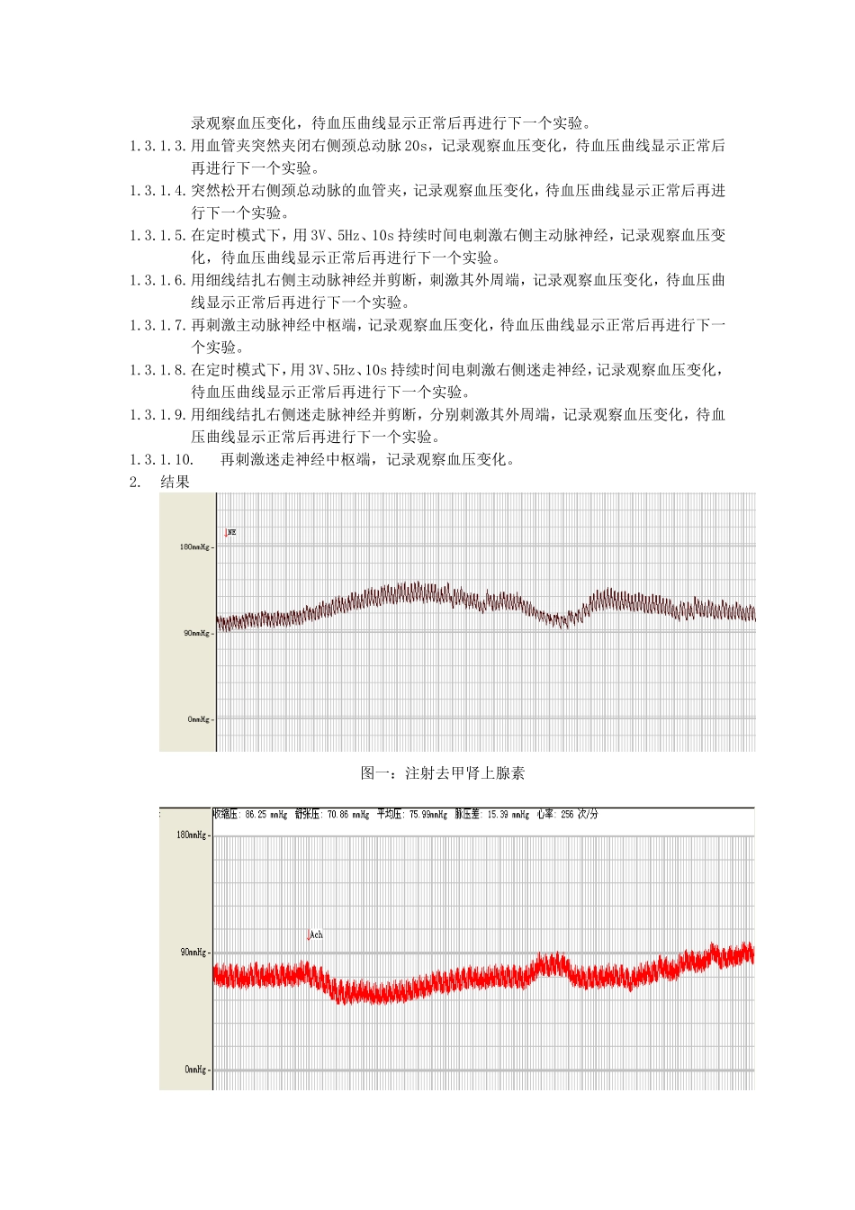 不同因素对家兔动脉血压的影响_第2页