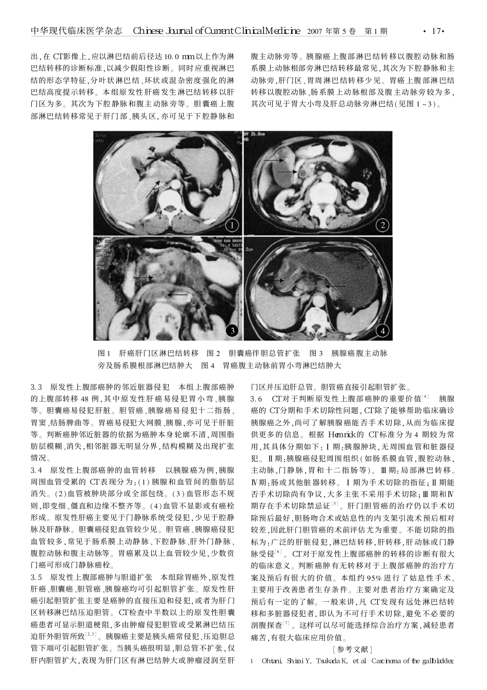 whxCT诊断原发性上腹部癌肿转移的临床意义_第2页