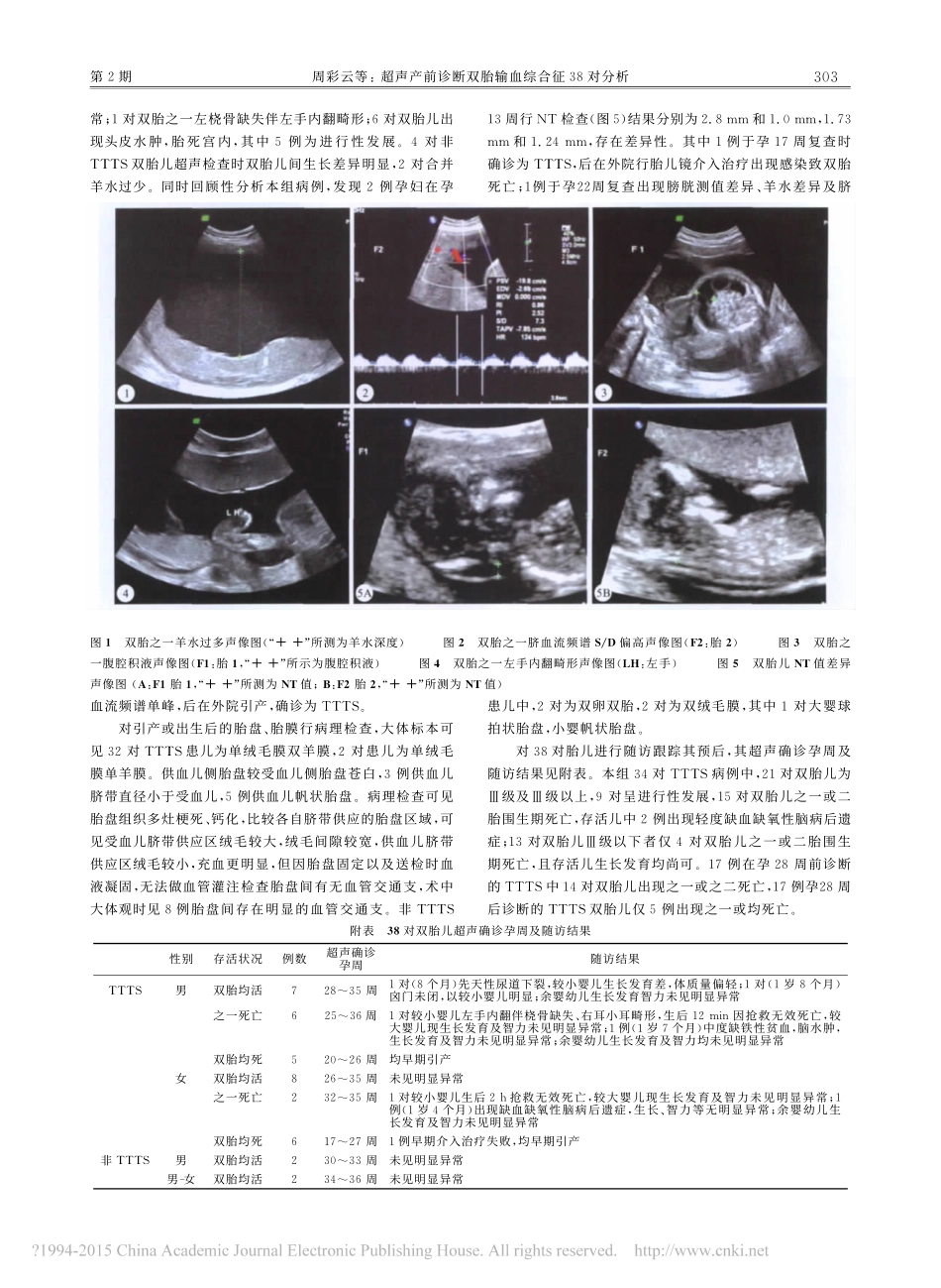 超声产前诊断双胎输血综合征38对分析_第2页