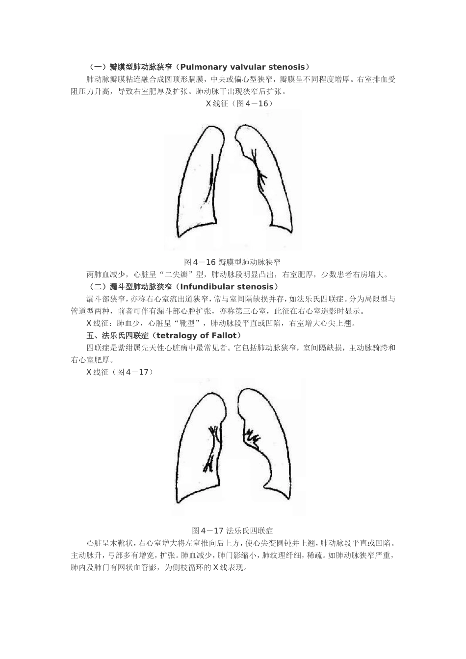 常见先心病的X线表现_第3页