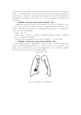 常见先心病的X线表现