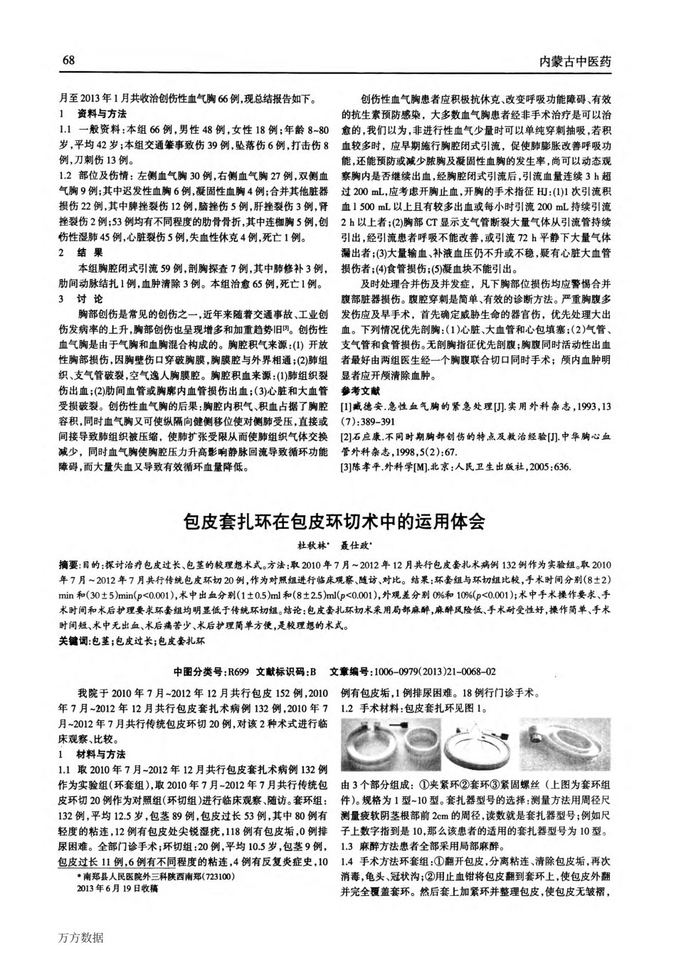 包皮套扎环在包皮环切术中的运用体会_第1页