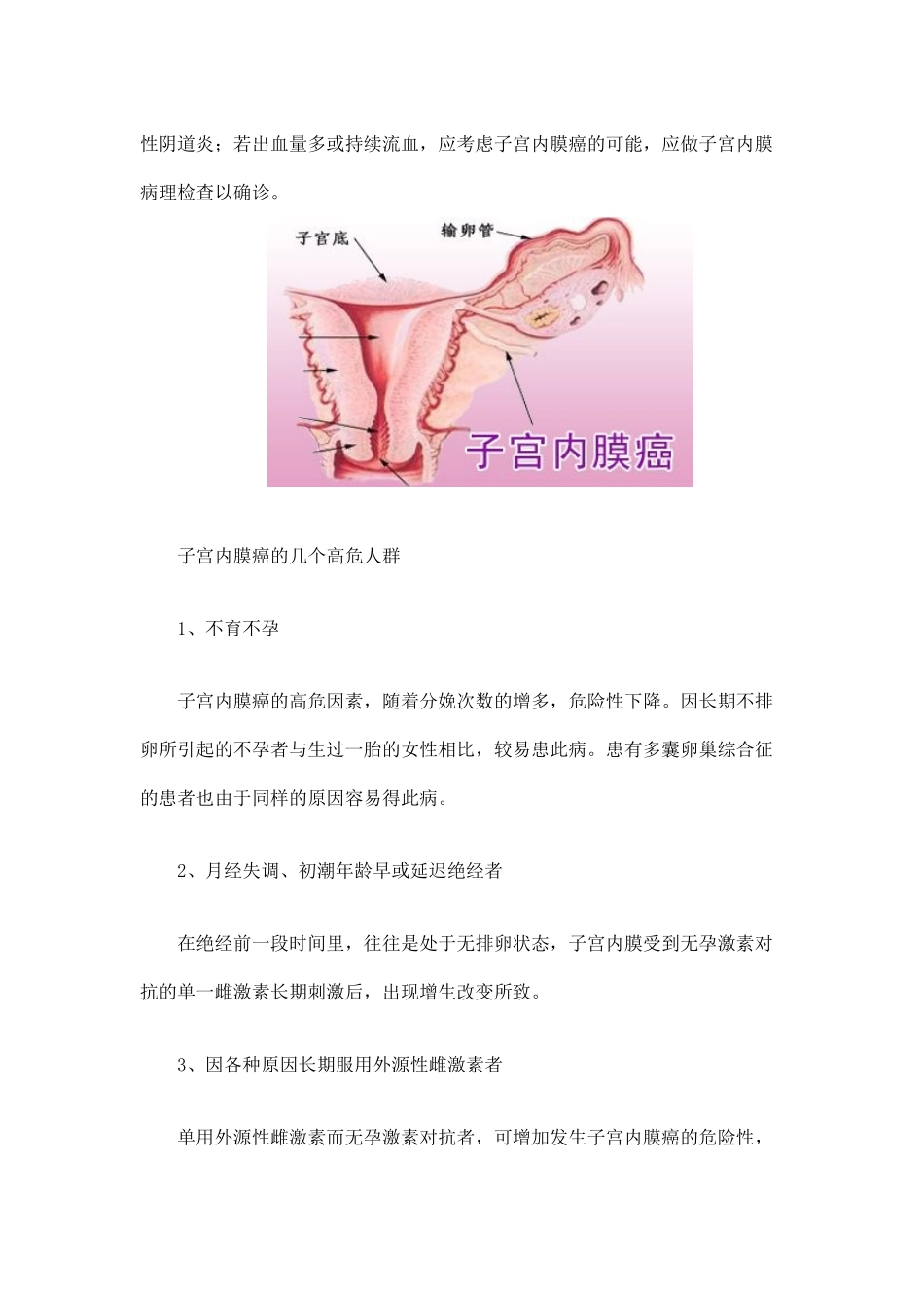 出现水样白带需警惕子宫内膜癌_第2页