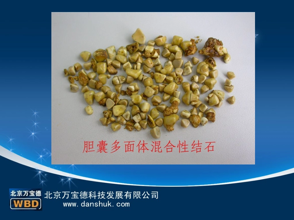 不吃早餐易患胆结石？_第2页