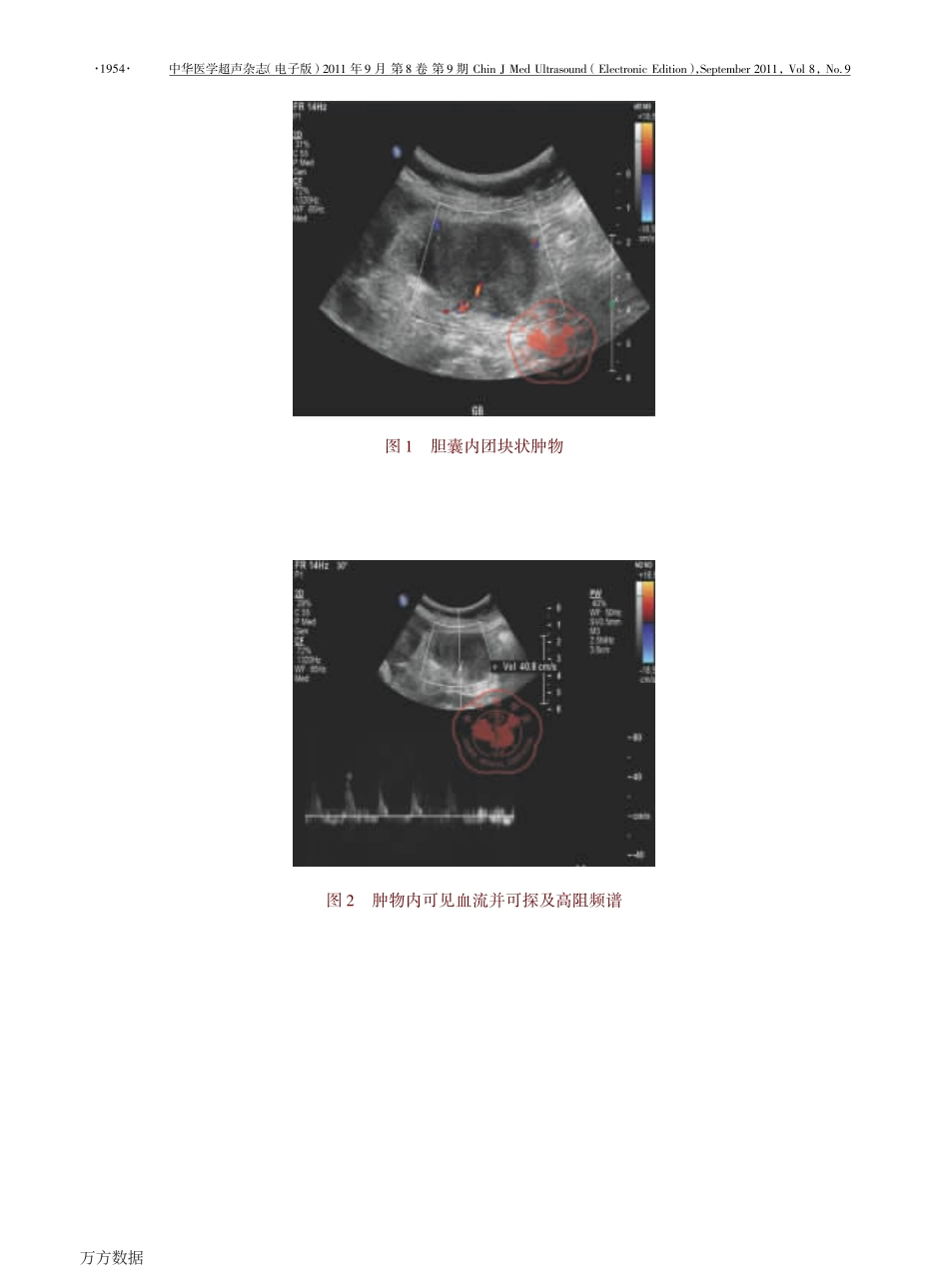 超声对胆囊癌的诊断价值_第3页