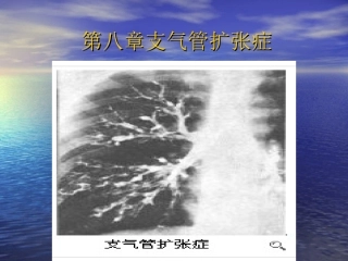 第八章支气管扩张症