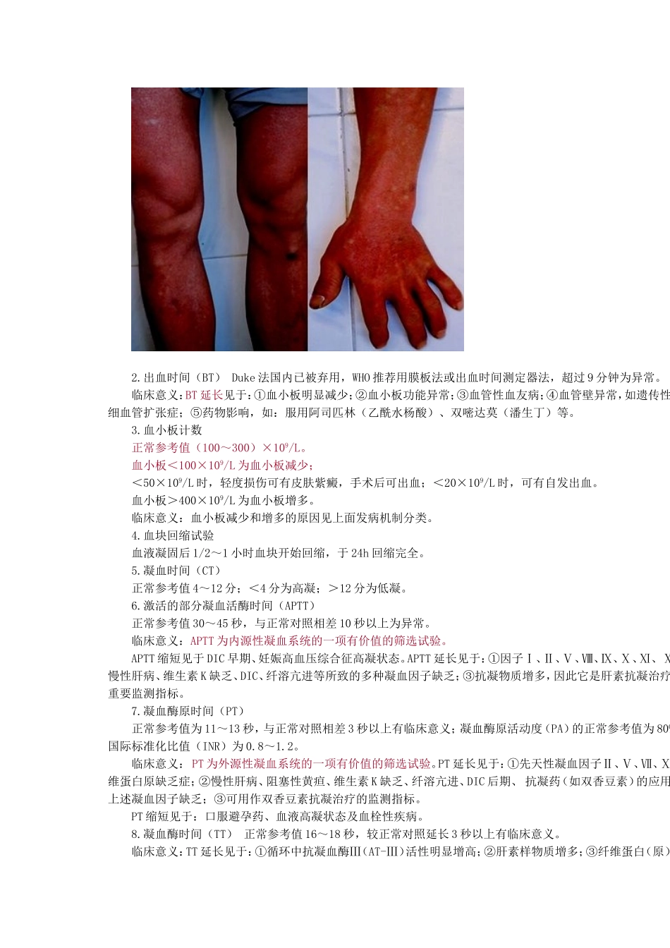 出血性疾病 Microsoft Word 文档_第2页