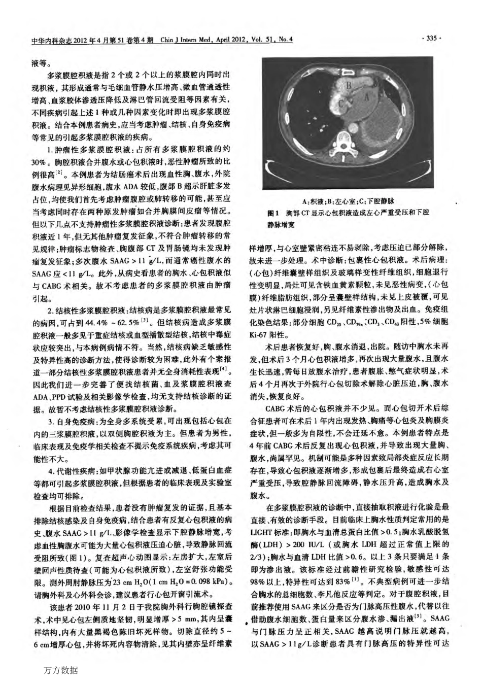 a病例讨论第414例——胸闷、腹胀及血性多浆膜腔积液_第2页