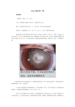 Usher综合征一例
