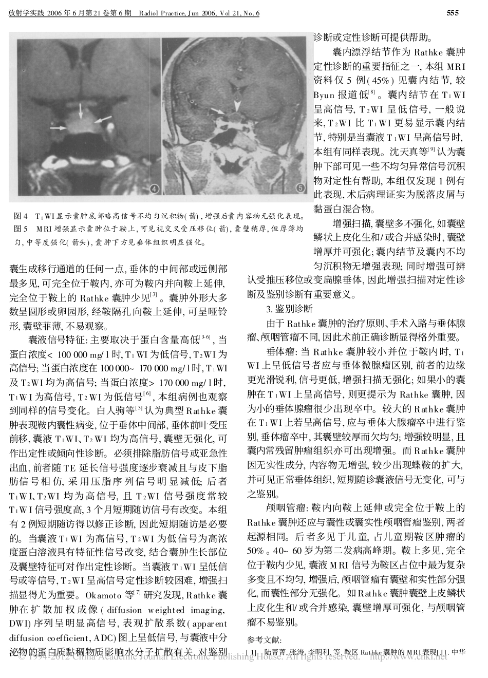 鞍区Rathke囊肿MRI诊断_第3页