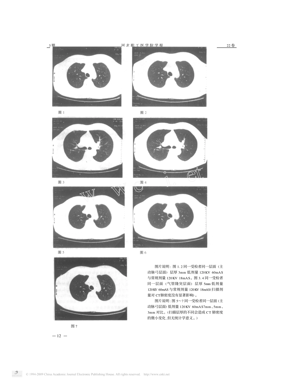 低剂量胸部CT扫描技术的临床应用_第2页