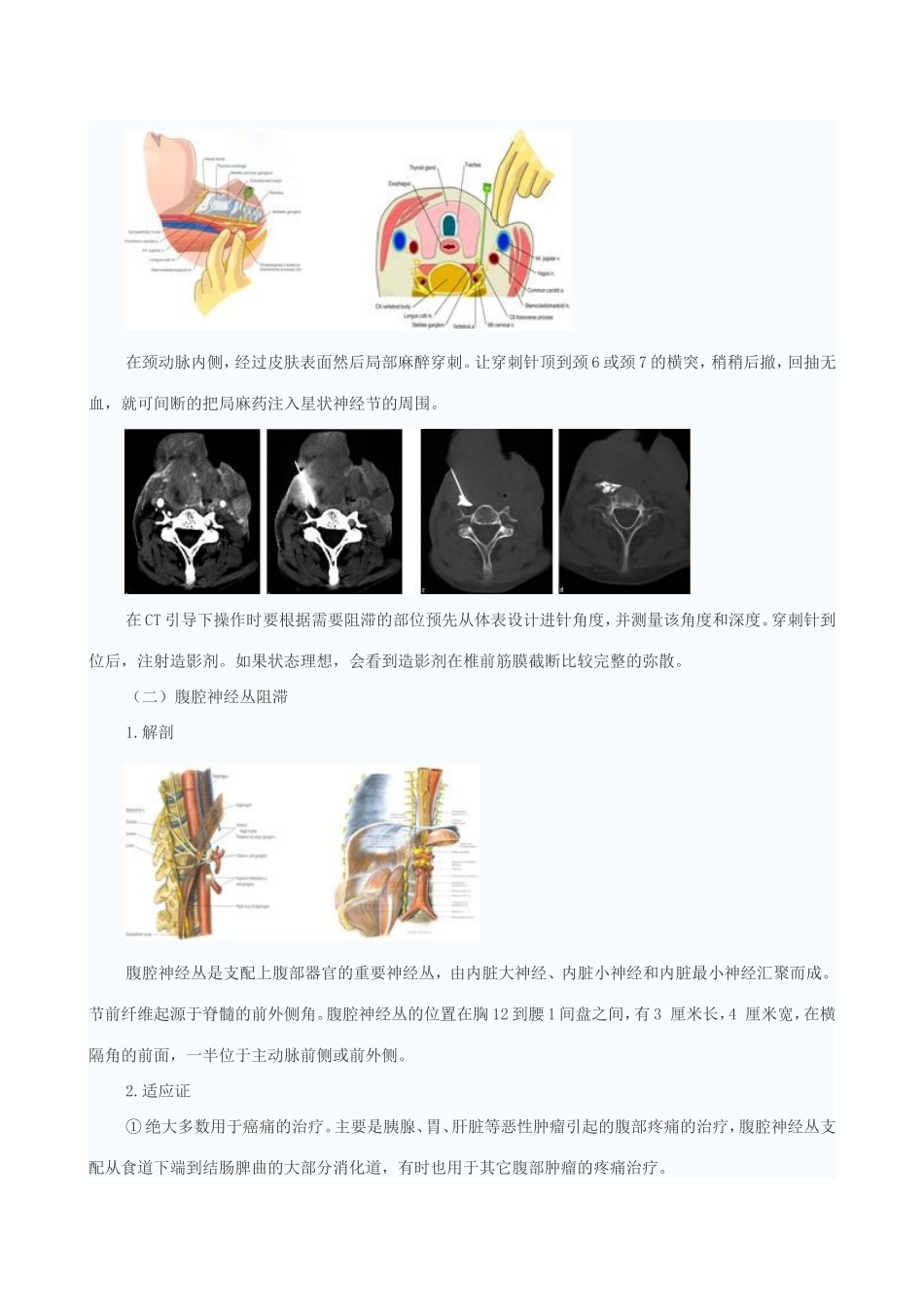 Ct引导下的疼痛介入治疗_第2页