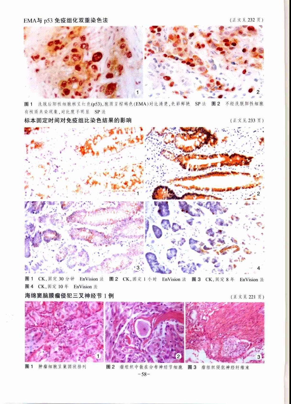 标本固定时间对免疫组化染色结果的影响_第3页