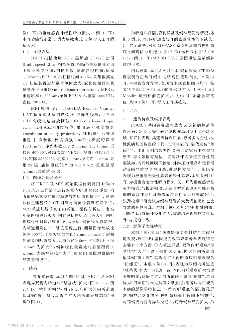 POU3F4基因突变致耳聋的HRCT和MRI表现_张宗建_第2页